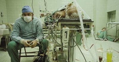 Dr. Zbigniew Religa After First Heart Transplant